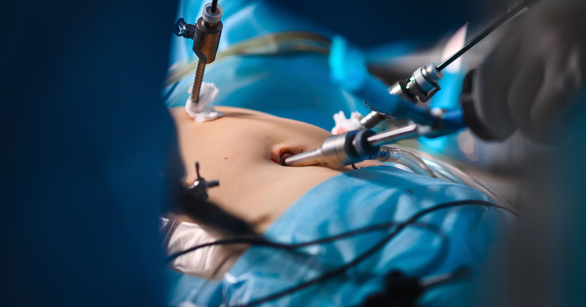 Scarless Tummy Tuck: Is It Possible?