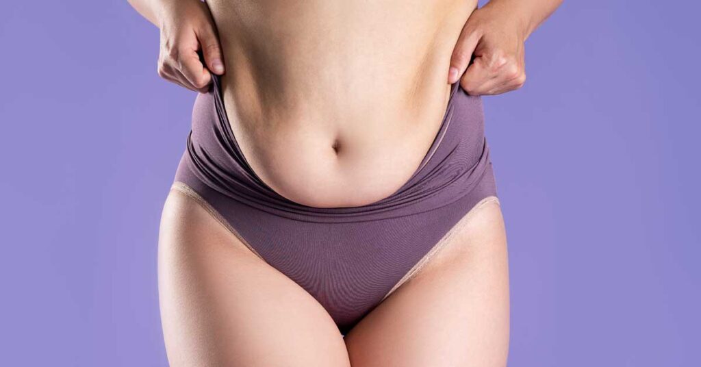 Scarless Tummy Tuck: Is It Possible?