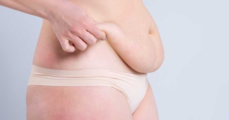 How to Get Rid of Hanging Belly After C-Section